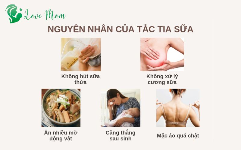 Nguyên nhân dẫn đến tắc tia sữa